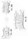 Fig. 31 - MEDICAL DEVICE AND METHOD