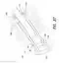 Fig. 34 - MEDICAL DEVICE AND METHOD