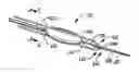 Fig. 01 - Cutting wire assembly for use with a catheter