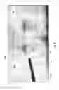 Fig. 09 - Trajectory guidance device and system for surgical instruments