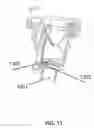 Fig. 17 - Trocar and wound closure device