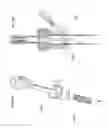 Fig. 24 - Trocar and wound closure device