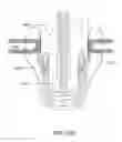 Fig. 33 - Trocar and wound closure device