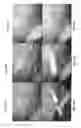 Fig. 51 - Trocar and wound closure device
