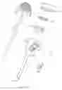 Fig. 06 - Trocar seal with retraction induced image
