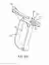 Fig. 19 - Medical device for removing an implanted object