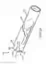 Fig. 41 - Medical device for removing an implanted object