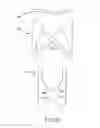 Fig. 48 - Medical device for removing an implanted object