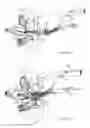 Fig. 10 - Functional uterine manipulator