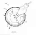 Fig. 12 - Functional uterine manipulator
