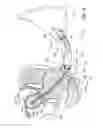 Fig. 09 - Uterine manipulators and related components and methods