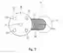 Fig. 07 - Obstetrical instrument