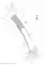Fig. 09 - Obstetrical instrument