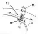Fig. 01 - Device for fixing a cranial limb to the cranial crown to be placed in the craniotomial hole or cutting, dedicated applying device and process for its use