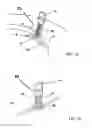Fig. 03 - Device for fixing a cranial limb to the cranial crown to be placed in the craniotomial hole or cutting, dedicated applying device and process for its use