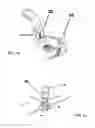 Fig. 05 - Device for fixing a cranial limb to the cranial crown to be placed in the craniotomial hole or cutting, dedicated applying device and process for its use