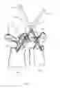 Fig. 34 - Single level fusion systems and methods of assembly and use