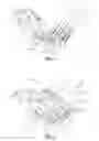 Fig. 02 - Systems and Methods for Correcting Spinal Deformity