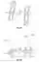 Fig. 08 - Systems and Methods for Correcting Spinal Deformity