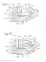 Fig. 07 - Multi-start closures for open implants