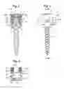 Fig. 03 - Bone anchoring device, tool and method for assembling the same and tool for use with the same