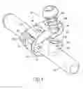 Fig. 02 - BONE FIXING SYSTEM AND METHOD OF USE