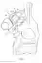 Fig. 04 - BONE FIXING SYSTEM AND METHOD OF USE