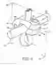 Fig. 05 - BONE FIXING SYSTEM AND METHOD OF USE