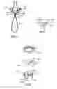 Fig. 13 - BONE FIXING SYSTEM AND METHOD OF USE