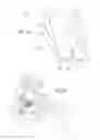 Fig. 15 - INTERSPINSOUS IMPLANTS AND METHODS