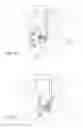 Fig. 19 - INTERSPINSOUS IMPLANTS AND METHODS