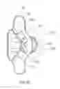 Fig. 28 - INTERSPINSOUS IMPLANTS AND METHODS