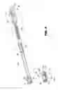 Fig. 04 - Instrument for inserting an interspinous process implant