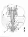 Fig. 18 - Instrument for inserting an interspinous process implant