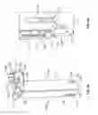 Fig. 10 - Tissue retraction and vertebral displacement devices, systems, and methods for posterior spinal fusion