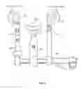 Fig. 11 - Tissue retraction and vertebral displacement devices, systems, and methods for posterior spinal fusion
