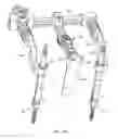 Fig. 14 - Tissue retraction and vertebral displacement devices, systems, and methods for posterior spinal fusion