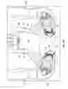 Fig. 15 - Tissue retraction and vertebral displacement devices, systems, and methods for posterior spinal fusion