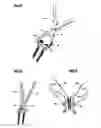 Fig. 12 - Device and method for spinal surgery