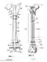 Fig. 03 - FLEXIBLE INTRAMEDULLARY NAIL