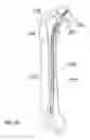 Fig. 11 - FLEXIBLE INTRAMEDULLARY NAIL