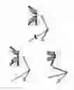 Fig. 10 - Orthopedic bone plate system