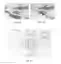 Fig. 11 - Orthopedic bone plate system