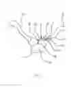 Fig. 02 - Internal fixation plate for sternoclavicular joint