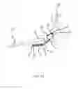 Fig. 13 - Internal fixation plate for sternoclavicular joint