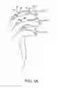 Fig. 04 - Dip fusion spike screw