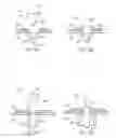 Fig. 16 - Methods and devices for intracorporeal bonding of implants with thermal energy