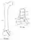 Fig. 22 - Methods and devices for intracorporeal bonding of implants with thermal energy