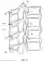 Fig. 28 - Methods and devices for intracorporeal bonding of implants with thermal energy