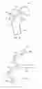 Fig. 33 - Methods and devices for intracorporeal bonding of implants with thermal energy